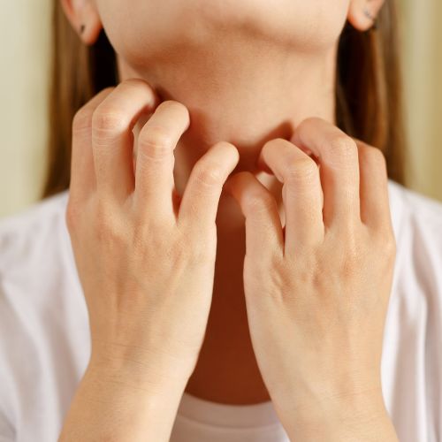 Epicutan teszt - Allergiaközpont